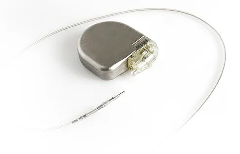 Implantable Cardioverter Defibrillator (ICD):